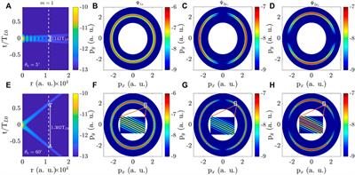 Photoelectron momentum distributions with twisted attosecond X waves carrying orbital angular momentum